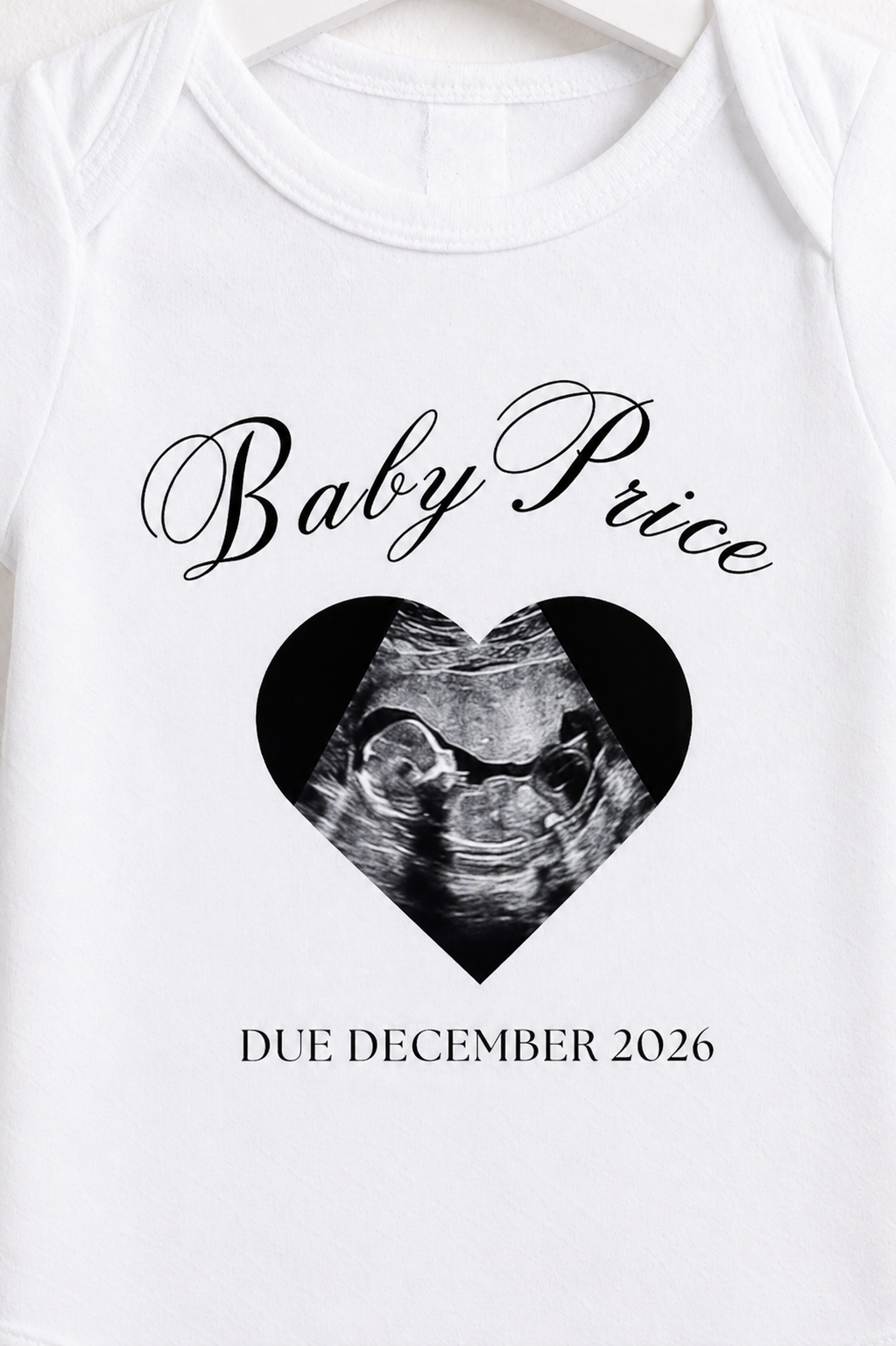 Personalised Scan Photo Baby Grow